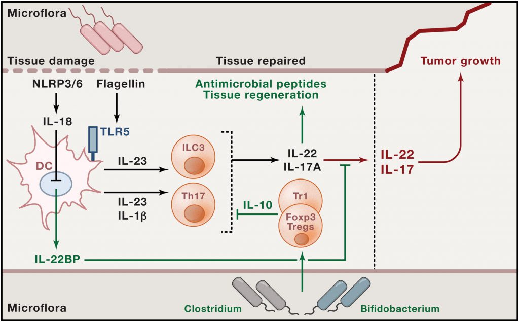 Interplay between Microbes, Proinflammatory, and Anti-Inflammatory Immune Cells and Cytokines that May Influence Tumor Growth