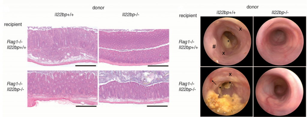 A pathogenic role of CD4+ Tcell–derived IL-22BP in a murine colitis model.