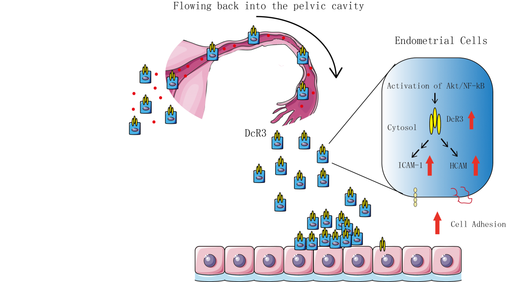 DcR3-Is-the-Key-Factor-of-Endometriosis