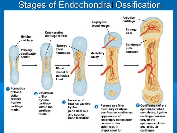 Histone Deacetylase Control endochondral bone formation by Cytokine Signaling and Matrix remodeling