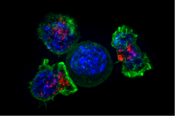 Nat Med: Key Factors Determining the Anticancer Effect of Immunological Checkpoint Therapy