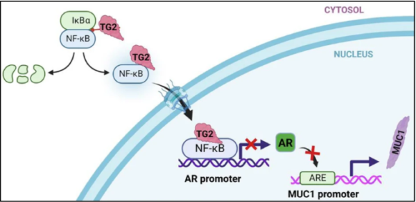 Mutated TG2 Enzyme Promotes the Progression and Diffusion Mechanism of Prostate Cancer