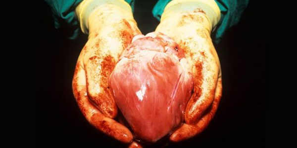 Would You Accept a Pig's Heart One Day?