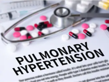 The Use of Activin/GDF Fusion Protein Is Expected to Treat Pulmonary Hypertension