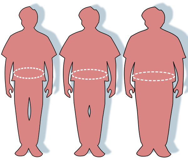 Ways to Promote Durable Weight Loss in Obese Patients Found