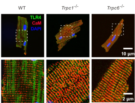 TRPC can significantly regulate the pathogenesis of endotoxemia