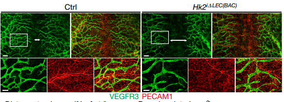 Fig2. Molecular mechanism on how ME deficient induce cell death.