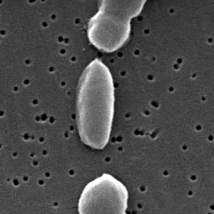 Vibrioparahaemolyticus