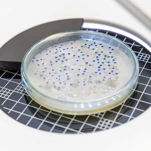 Totalbacterialcount(TBC)