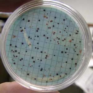 Enumerationoffecalcoliforms