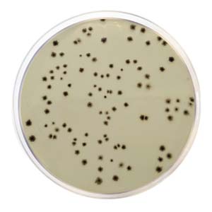 Anaerobicsulfite-reducingClostridia