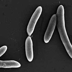 Desulfotomaculumnigrificans