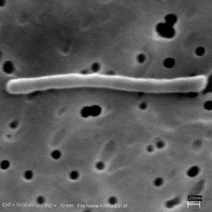 Thermoanaerobacteriumthermosaccharolyticum