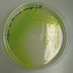 Pseudomonasaeruginosa