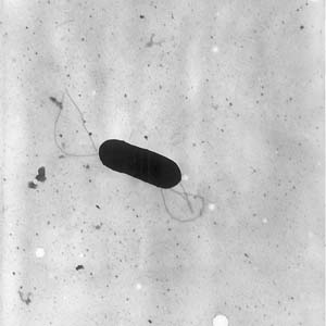 Listeriamonocytogenes