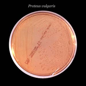 Proteusbacillus