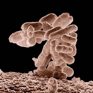 EscherichiacoliO157:H7