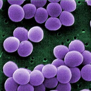 Staphylococcusaureus