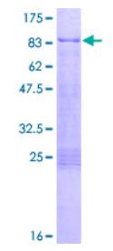 AFM results