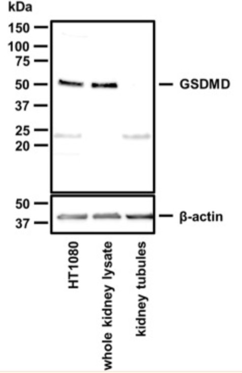 Fig4. Western blot of murine GSDMD.