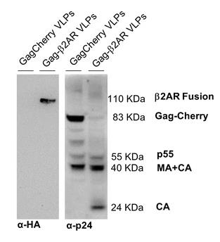 Fig. 2. Characterization of Gag-VLPs in ultracentrifuged supernatant samples from Sf9-GagCherry-11 and
          Sf9-Gag-β2AR cell cultures. (Vidigal,
          <em>et al.</em>
          2018)