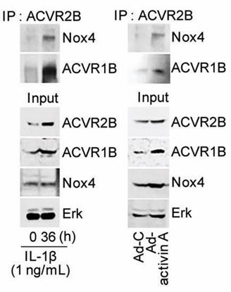 ACVR2B-197H-4.jpg