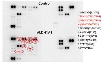 ALDH1A1-2.jpg