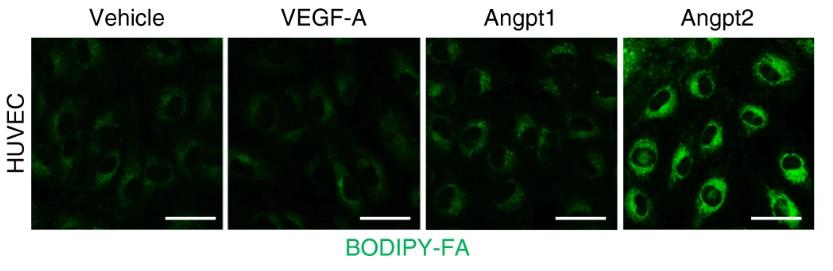 ANGPT2-3182H-1.jpg