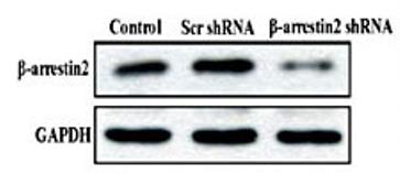 ARRb2-3639H-4.jpg