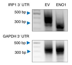 ENO1-3.jpg