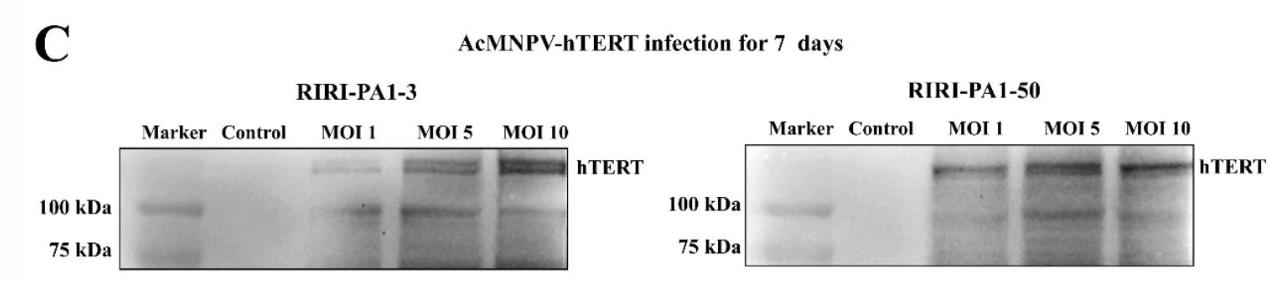 TERT-2.jpg