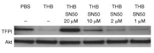 TFPI-4.jpg