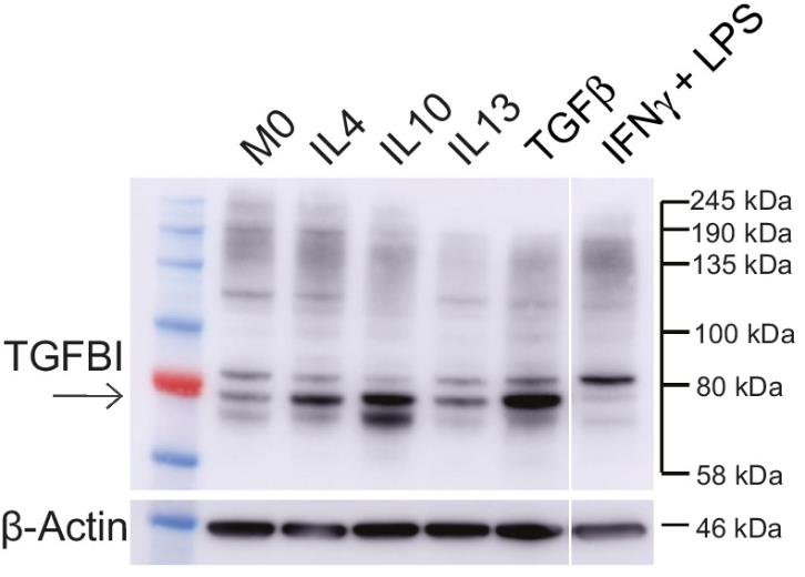 TGFBI-4.jpg