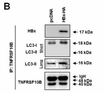 TNFRSF10B-4.jpg