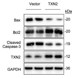 TXN2-2.jpg