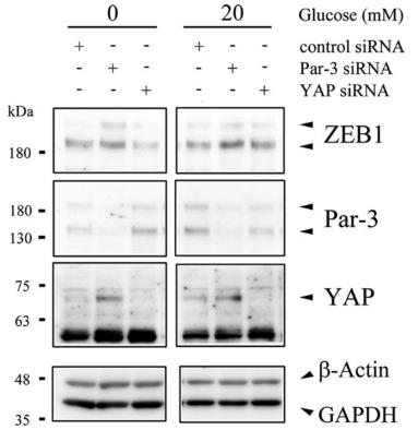 YAP1-4.jpg