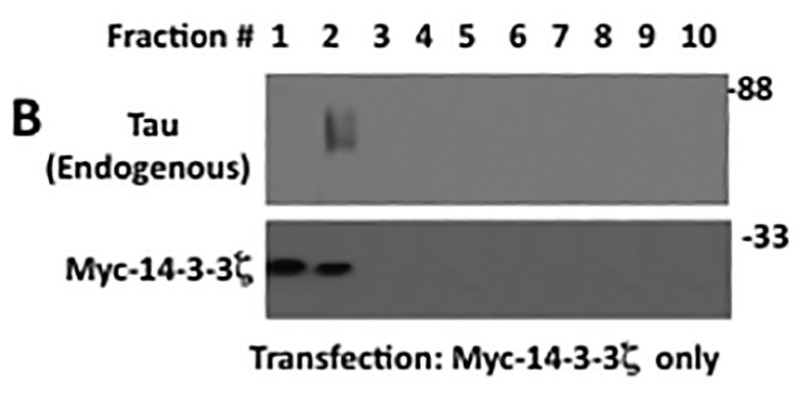 YWHAZ-104H-3.jpg