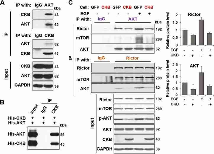 CKB interacts with AKT and inhibits AKT activation. (A) CKB and AKT proteins could reciprocally co-immunoprecipitate (co-IP) each other from LNCaP cells. (B) AKT protein was immunoprecipitated by CKB antibody in a mixture of recombinant His-tagged AKT and His-tagged CKB proteins. (C) PC3-GFP and PC3-CKB cells were treated with or without 100ng/ml EGF for 5 min. Endogenous AKT was immunoprecipated from these 2 cell lines using AKT Ab, followed by immunoblotting for Rictor, mTOR and AKT (top). Conversely, endogenous Rictor was immunoprecipated using Rictor Ab, then immunoblot for AKT, mTOR and Rictor (middle). Immunoblotting of the input whole cell lysates was shown in bottom. Fold changes of Rictor and AKT protein levels in the IP samples are plotted, relative to the sample without EGF and without CKB overexpression. The quantification is based on measurements from 2 independent experiments, using ImageJ software.