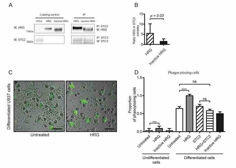 Recombinant HRG binds STC2 and modulates phagocytosis of bioparticles. ( A ) Co-immunoprecipitation of HRG but not inactive HRG with STC2. Recombinant proteins (2 μg each) were separated on SDS-PAGE as individual preparations (loading control) or after mixing and immunoprecipitation (IP) using antibodies against STC2, followed by immunoblotting (IB) as indicated. ( B ) Ratio of HRG (active or inactive) band intensities in the STC2 immunoprecipitate normalized to corresponding active and inactive HRG loading controls. Statistical analysis; Student’s t -test. ( C ) Representative microscope images of U937 monocytes without (left) or with treatment with active HRG (right) in the phagocytosis assay. Green cells have engulfed pH-sensitive fluorescent bioparticles. Scale bar; 50 μm. ( D ) Quantification of phagocytosis efficiency in the different treatment conditions. The proportion of positive (green) phagocytotic U937 cells to all cells per field of vision is shown in relation to the positive cells/total cells in the vitD3 differentiated HRG-treated condition (set to 1). Statistical analysis; Tukey’s multiple comparisons test ( D ). *** p < 0.001; **** p < 0.0001.