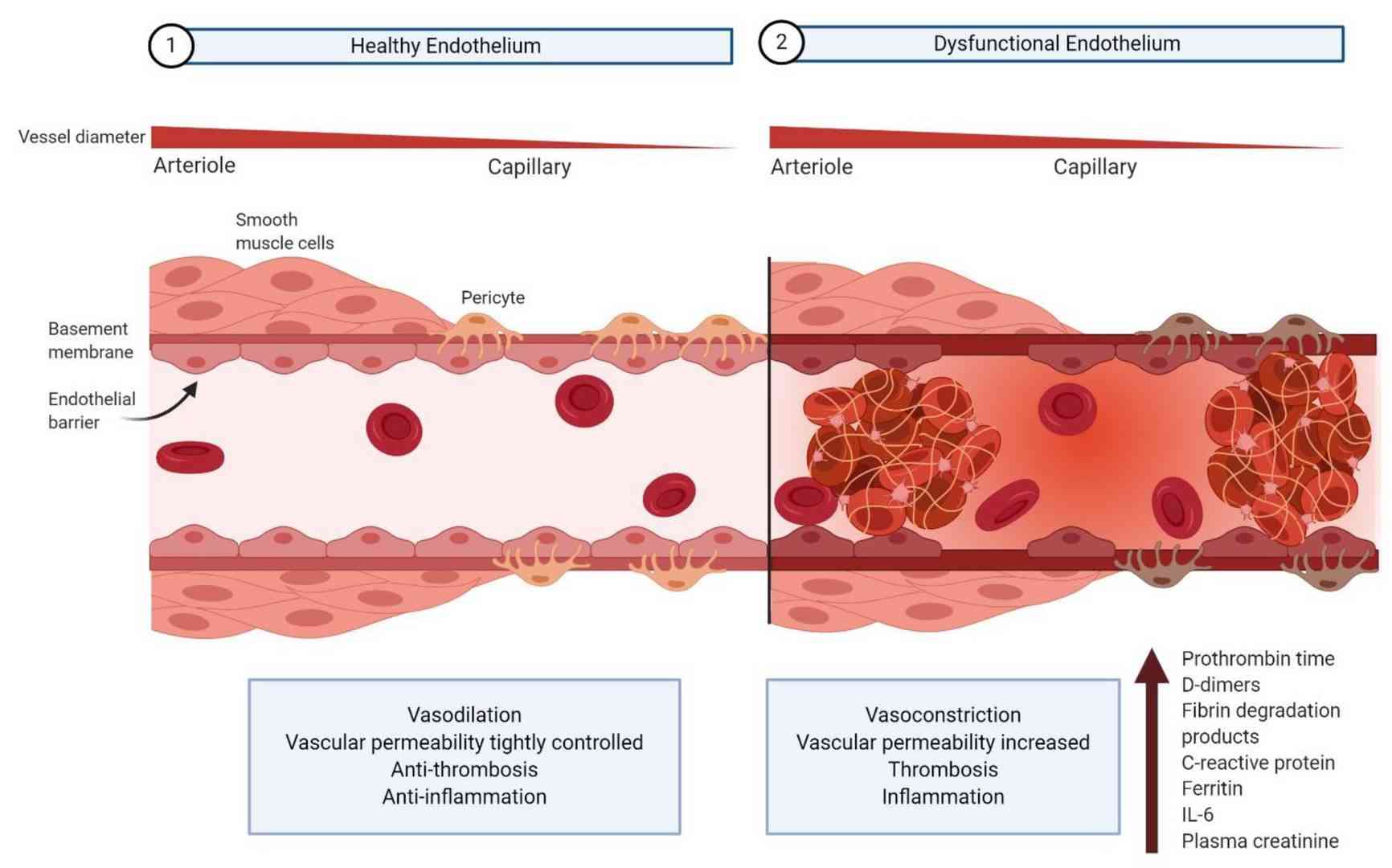 Dysfunctional vascular endothelium causes vasoconstriction, increased permeability, thrombosis, and inflammation.