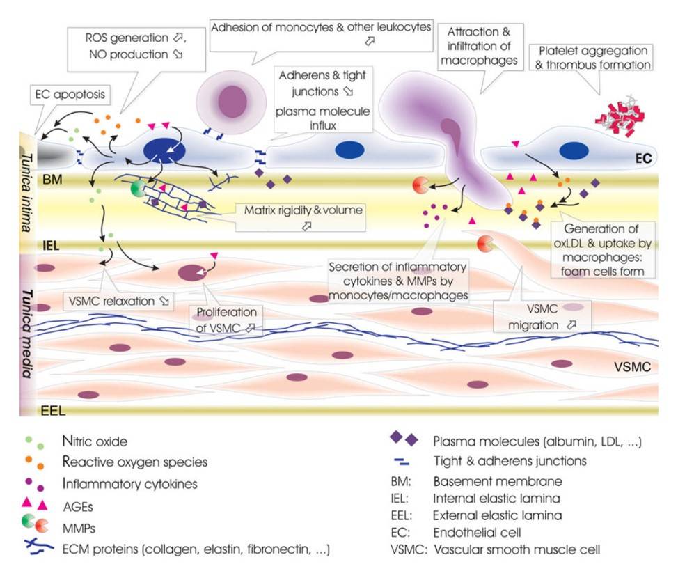 Diabetic vessels exhibit endothelial dysfunction, macrophage infiltration, increased ECM, VSMC proliferation, and thrombogenesis.