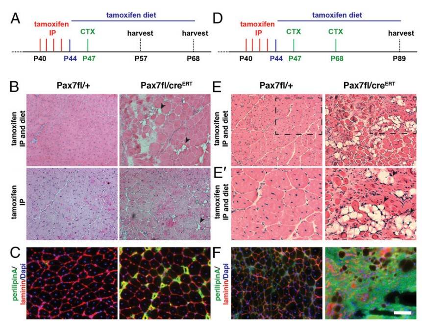 Inactivation of Pax7 impairs muscle regeneration and increases adipogenesis after injury.