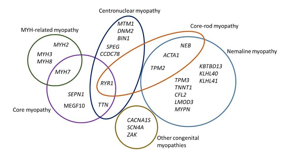 Diagram of 27 congenital myopathy-causing genes, highlighting overlaps between nemaline and core myopathies.