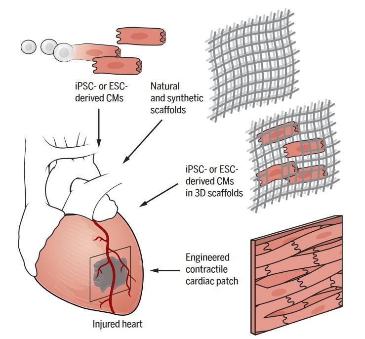 Stem cell-derived cardiomyocytes and scaffolds assist heart regeneration via transplantation or endogenous repair.