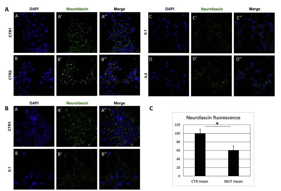 ICF studies show reduced Neurofascin expression in iPSC-derived neurons from affected siblings.