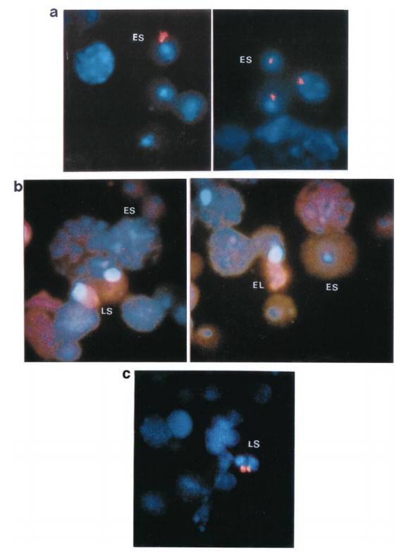 Distribution of Spam1 and Prm1 mRNA in spermatids shows distinct compartmentalization and variation patterns.