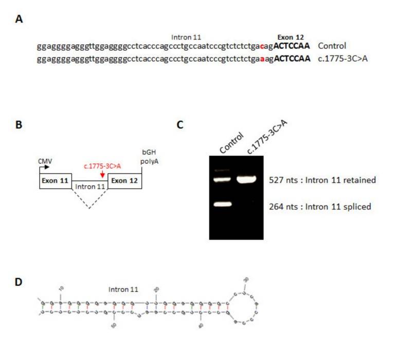 Splicing effect of ZP1 mutation shown through sequence analysis, minigene construction, and RT-PCR results.