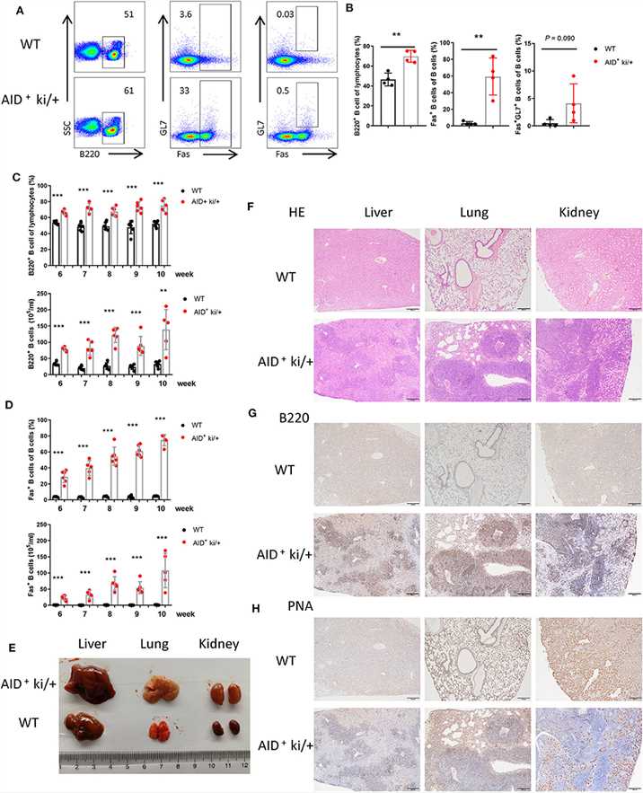 B cell expansion in the lung, liver, and kidney from blood in GC B cell specific c-MYC and BCL2 expression mice.