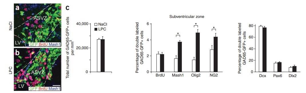 Demyelination increases GAD65-GFP-positive cells expressing glial lineage markers in the SVZ and corpus callosum.