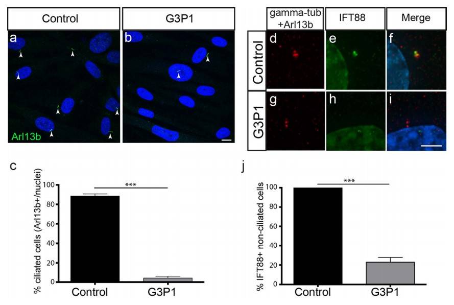 Impaired ciliogenesis and IFT protein recruitment in G3P1-mutant fibroblasts, reduced IFT88 localization.